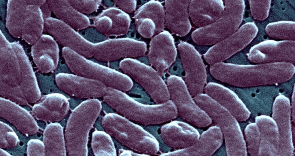 Louisiana reports 5 deaths from ‘flesh-eating’ bacteria found in oysters and swimming water: How to reduce your risk of a Vibrio vulnificus infection.
