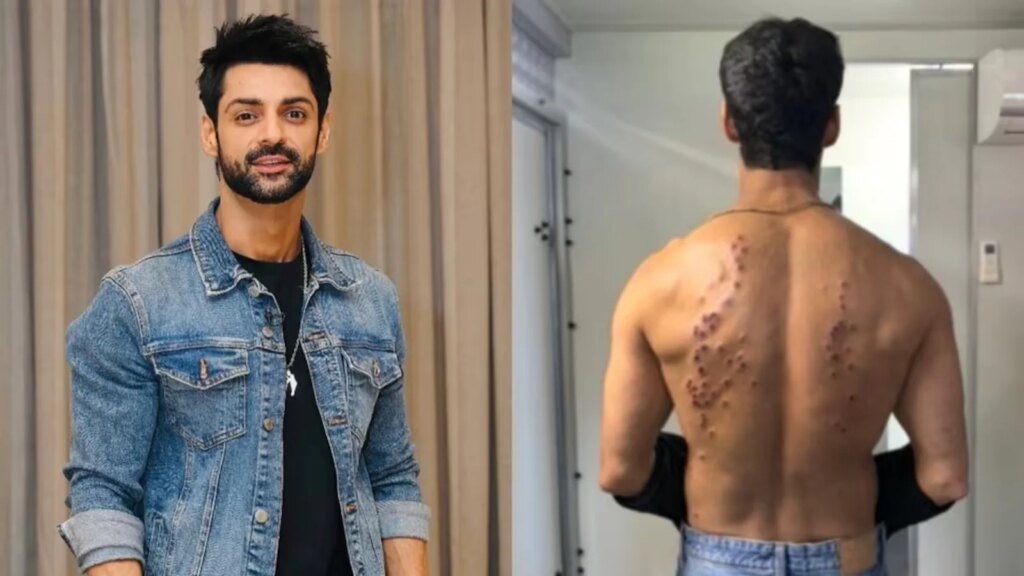 ‘Went Numb’: After Gaurav Khanna, Karan Wahi Reacts To Khatron Ke Khiladi 15’s Painful Rubber Bullet Task
